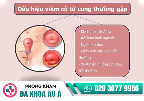 KHÍ HƯ ĐẶC, KHÍ HƯ VÓN CỤC LÀ DẤU HIỆU BỆNH GÌ?